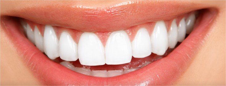 diseno de sonrisa