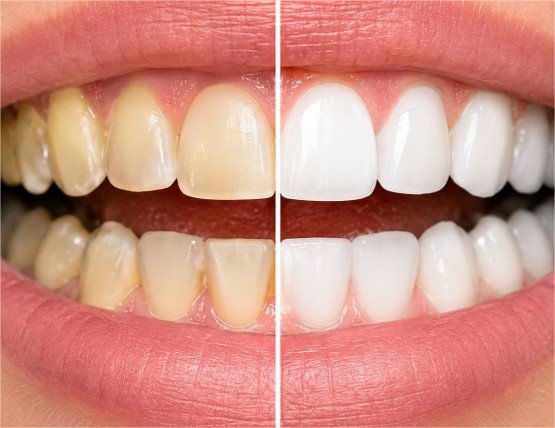 tratamientos dentales